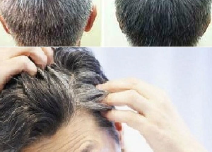 Usia Muda Rambut Sudah Beruban, Ini Cara Alami yang Bisa Dilakukan