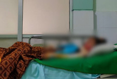 Arini Putri, Remaja Korban Luka Bakar, Dirawat di RS DKT Baturaja