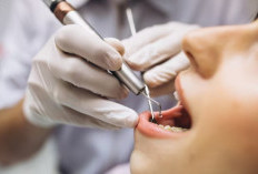 5 Alasan Penting untuk Lakukan Perawatan Gigi Rutin Secara Berkala