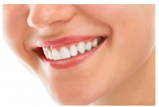 5 Mitos Vs Fakta Seputar Gigi Putih dan Cantik Yang Harus Kamu Tahu