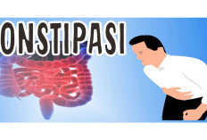 Jangan Anggap Santai Konstipasi, Bisa Jadi Karena Hal Ini!
