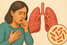 TBC di Indonesia Masih Tinggi, Ahli RS Ernaldi Bahar Ingatkan Bahaya Putus Obat