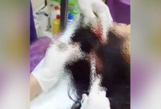  Kepala IRT Dijahit, Diduga akibat Dianiaya Suami dan Perempuan Lain