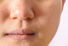 Mengatasi Kulit Kering di Area Hidung, Solusi Praktis untuk Kulit yang Sehat dan Cantik