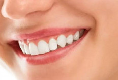 Rahasia Senyuman Sehat: 6 Langkah Ampuh Menghilangkan Kerak Gigi dengan Mudah, Boleh Dicoba Nih!