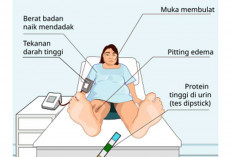 Waspada, Eklampsia Berisiko Ancam Nyawa jika Tak Ditangani Segera