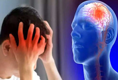  Tak Ditangani Segera, Stroke Bisa Sebabkan Kerusakan Otak hingga Kematian