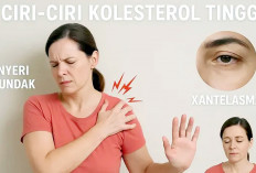 Ayo Cek Kolesterol sejak Dini demi Cegah Stroke dan Serangan Jantung