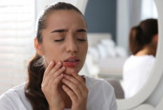 Cara Mengatasi Sariawan