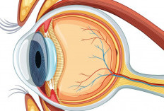 Mengenal Tumor Mata: Jenis, Gejala, Penyebab, dan Cara Pengobatannya