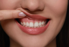 7 Tips Menjaga Kesehatan Gigi agar Tetap Sehat