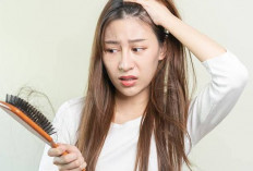 7 Cara Efektif Mengatasi Rambut Rontok dan Mencegah Kebotakan, Dijamin Berhasil