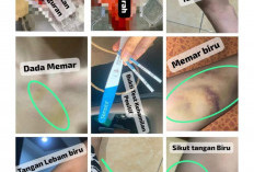 Biadab! Mahasiswa Aktif Diduga Aniaya Kekasih, Korban Alami Keguguran dan Trauma