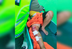 Dua Warga Lubuklinggau Korban Tabrak Lari Angkot hingga Patah Kaki, Begini Kondisinya 