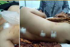 Main ke Rumah Pacar, Malah Ditikam, Diduga oleh Ayah sang Pacar