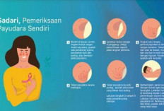 Yuk Deteksi Dini Kanker Payudara via SADARI dan SADANIS
