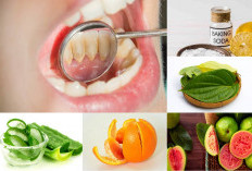 Simak, Ini 5 Bahan Alami yang Dapat Membersihkan Karang Gigi Membandel, Dijamin Ampuh