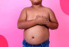 Orangtua Wajib Tau, Anak yang Obesitas Bisa Berumur Pendek
