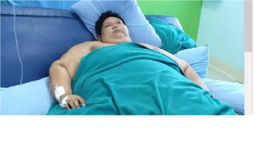 Dirawat 14 Dokter Ahli, Ini Kondisi Fajri Berbobot 300 kg Sebelum Meninggal