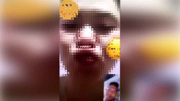 Indonesian Healthcare Worker Causes Stir! Video Call While Goes Viral